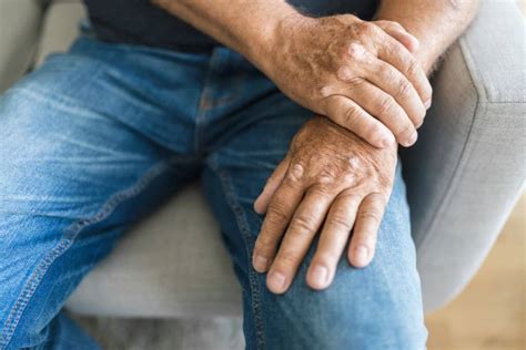 În Mod Natural Vindecarea Artritei Reumatoide - Cine și cum de a vindeca artrita reumatoida